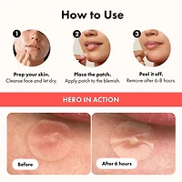 Hero Mighty Patch Original 24CT, Use Original for nighttime