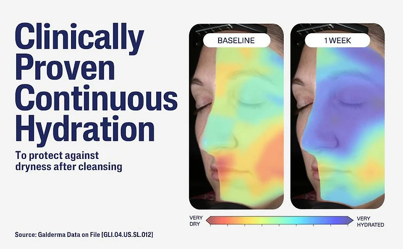 Cetaphil Nettoyant Doux Pour la Peau 236 ml | Nettoyant Visage et Corps Hydratant |  Idéal Pour les Peaux Sèches et Sensibles | Recommandé par les Dermatologues