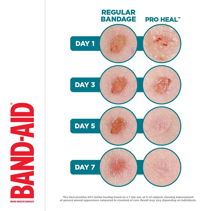 Band-Aid Pro Heal Adhesive Bandages, Regular Size, First Aid, Wound Care Dressing, Waterproof Healing Bandage, 10 Count