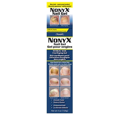 Xenna Nonyx Nail Gel, 120 g