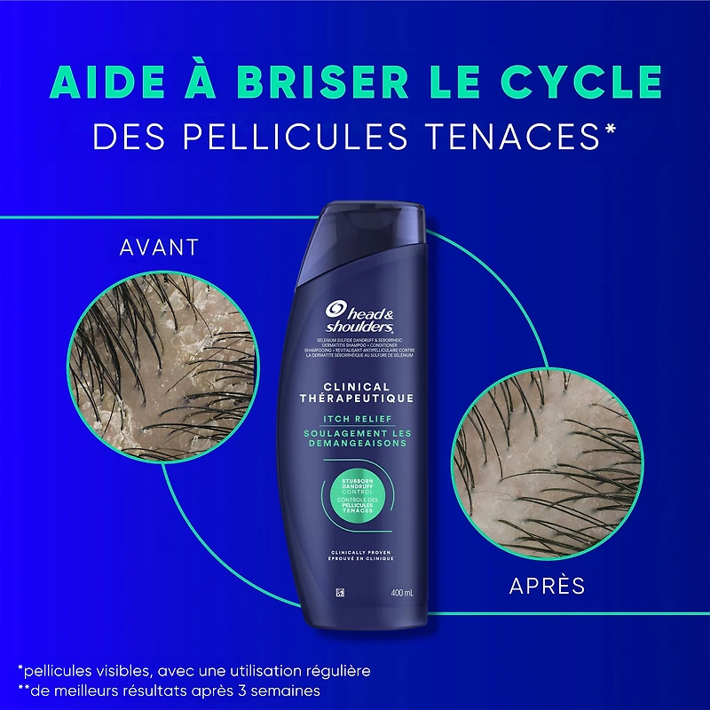 Shampooing Head & Shoulders Action thérapeutique Soulagement des démangeaisons intenses 400 ml