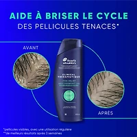 Shampooing Head & Shoulders Action thérapeutique Soulagement des démangeaisons intenses 400 ml