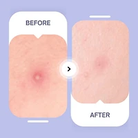 Maskeraide, Hydrocolloid Acne Patch, Acne Spot Treatment, Clear Pimple Patches, Spotted Nighttime, 54pcs