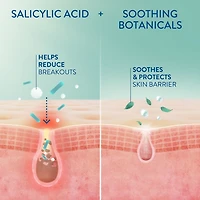 Cetaphil Gentle Clear Acne Moisturizer With Salicylic Acid | Hydrating Face Moisturizer Treats Sensitive Acne Prone Skin | Fragrance-Free | Non-Comedogenic | Dermatologist Recommended, 89ml