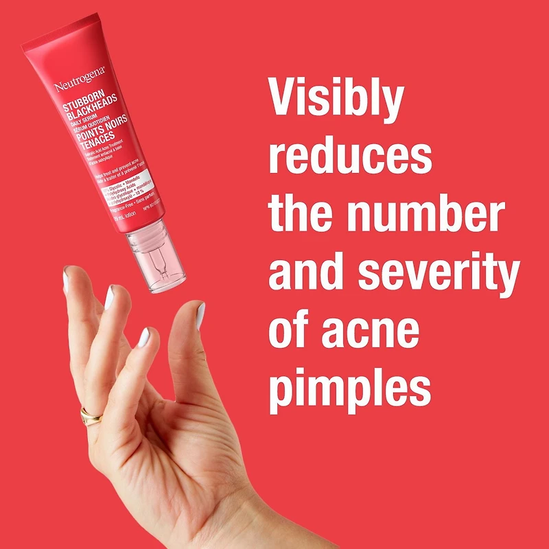 Sérum quotidien Points noirs tenaces Neutrogena, traitement antiacné à base d'AAH, d'acide salicylique, et d'acides glycolique + mandélique + polyhydroxylé, Sans parfum 29 ml