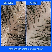 Head & Shoulders Green Apple Anti-Dandruff Conditioner, 325ML