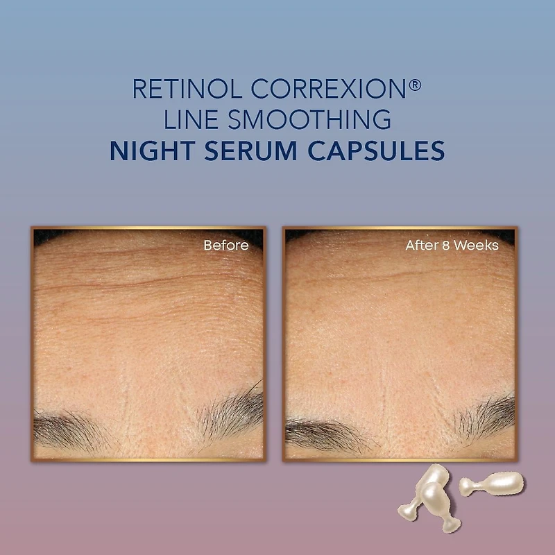 RoC Skincare - Retinol Correxion®️ - Capsules de Sérum de Nuit de Lissage de Ligne (30 U) RoC Skincare