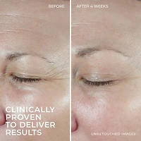 RoC Skincare - Hydration + Moisturizer®️ - + Hyaluronic Acid + Collagen Protein - 48gm, RoC Skincare