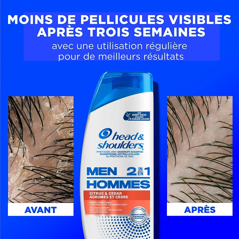 Shampooing et revitalisant antipelliculaire 2 en 1 Head and Shoulders pour hommes, traitement antipelliculaire, Agrumes et cèdre pour un usage quotidien, sans parabènes 370 ml