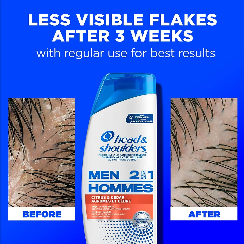 Head and Shoulders Mens 2 in 1 Dandruff Shampoo and Conditioner, Anti-Dandruff Treatment, Citrus & Cedar for Daily Use, Paraben Free, 370ML
