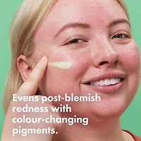 Baume SOS Crème Verte Correctrice De Teint Après le traitement des boutons
