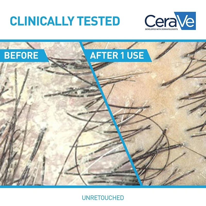 CeraVe Shampooing Hydratant Antipelliculaire, Shampooing Testé avec 1 % Pyrithione de Zinc, 355 ml Réduit les pellicules