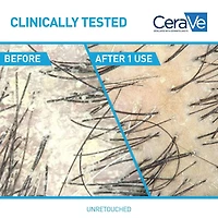 CeraVe Shampooing Hydratant Antipelliculaire, Shampooing Testé avec 1 % Pyrithione de Zinc, 355 ml Réduit les pellicules