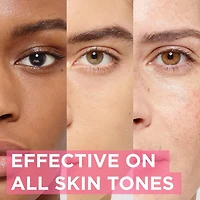 L'Oreal Paris Revitalift Triple Power LZR 5% Glycolic Acid Peeling Toner with Aloe Vera, Smooth Skin & Reveal Glow, Daily Exfoliant for Brighter Skin, Fragrance and Alcohol Free, 180 mL