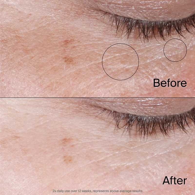 Gel-crème régénérant pour les yeux Neutrogena Collagen Bank, hydratant non parfumé pour la zone sous les yeux qui aide à préserver le collagène, améliore visiblement les cernes et les poches, niacinam