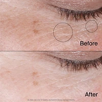 Gel-crème régénérant pour les yeux Neutrogena Collagen Bank, hydratant non parfumé pour la zone sous les yeux qui aide à préserver le collagène, améliore visiblement les cernes et les poches, niacinam