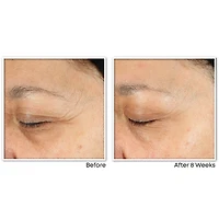 RoC Skincare - Sérum Quotidien Revitalisation + Éclat Multi Correxion 30mL