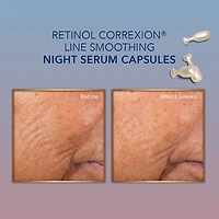 RoC Skincare - Retinol Correxion®️ - Capsules de Sérum de Nuit de Lissage de Ligne (30 U) RoC Skincare