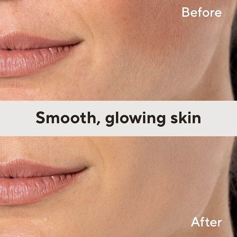 Finishing Touch Flawless Dermaplane Glow Facial Exfoliator & Hair Remover, 1 unit, 6 replacement blades