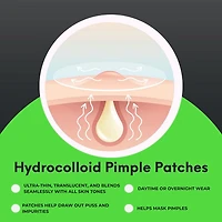 Oxy Invisible Pimple Patches for Acne, – Hydrocolloid Acne Patches with Tweezers, Variety pack – Absorbs Pus, Long-Lasting, Day & Night Use