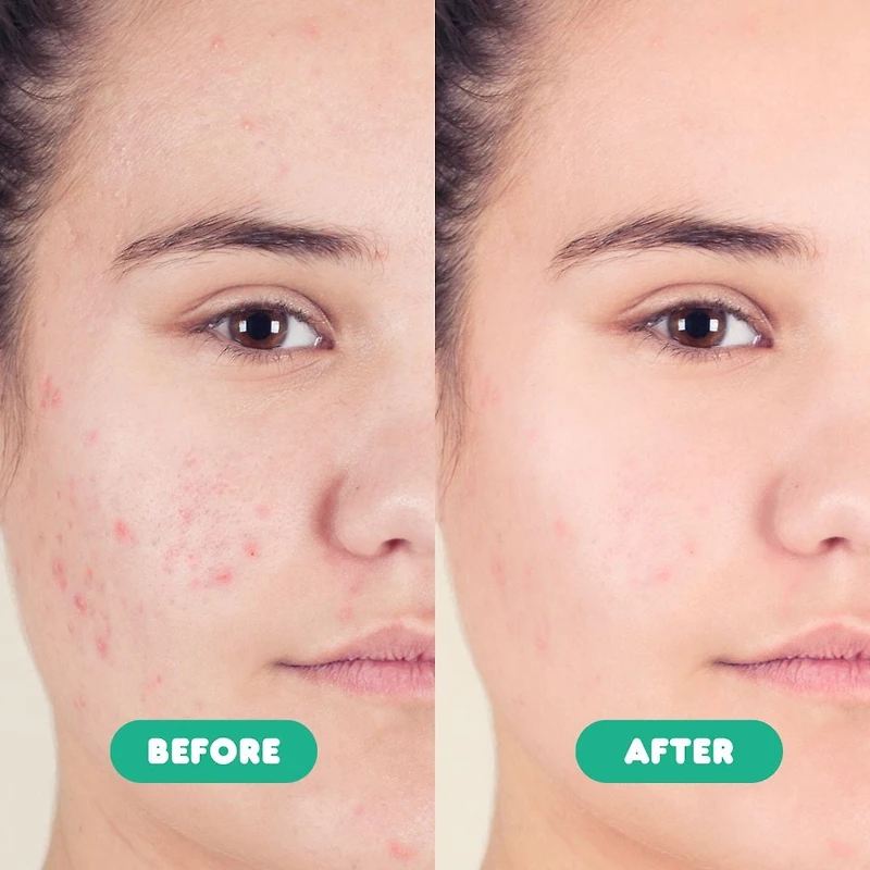 SoloVegan 2% BHA Oil Control Gel Cleanser