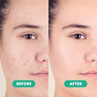 SoloVegan 2% BHA Oil Control Gel Cleanser