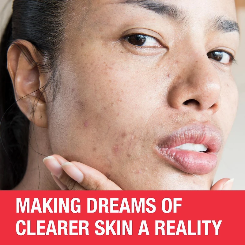 Neutrogena Stubborn Marks PM Treatment - Acne, Retinol Skin Care, Vitamin A - post-acne marks exfoliator - Fragrance Free