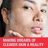 Neutrogena Stubborn Marks PM Treatment - Acne, Retinol Skin Care, Vitamin A - post-acne marks exfoliator - Fragrance Free