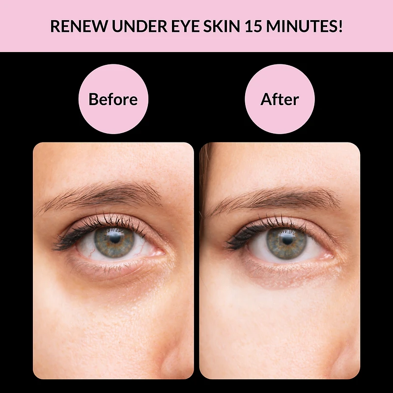 Soo'AE Mon Patch Yeux Collagène Hydrogel Volume / Quantité - 0,35 oz. / 10 gr.