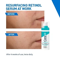 CeraVe Sérum Resurfaçant au Rétinol pour le Visage avec Niacinamide et Rétinol Encapsulé. Aide à uniformiser le Teint, à Améliorer la Texture de la Peau et à Réduire les Marques Post-Acnéiques. Doux, Un sérum léger pour le visage