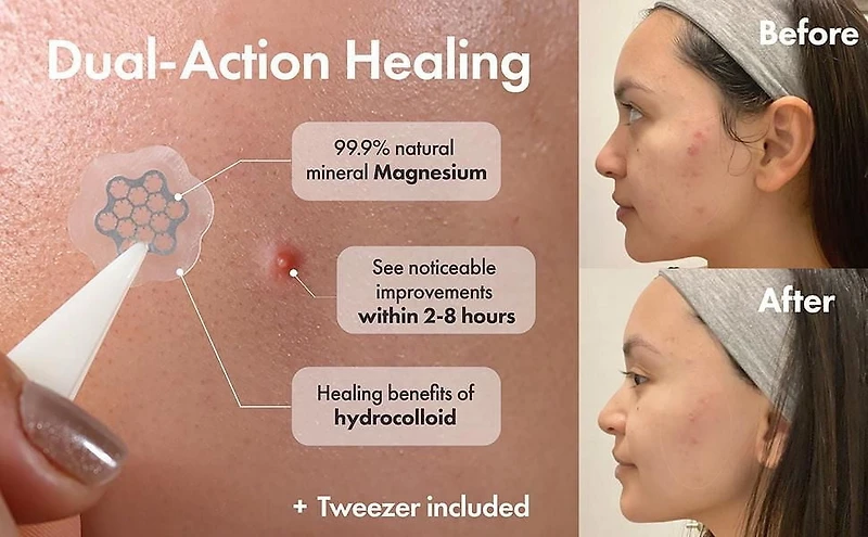 FREEGO MAGNESIUM PATCH - MINI (15EA/PACK)