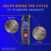 Shampooing 2 en 1 Head & Shoulders Intensité clinique Sécheresse du cuir chevelu, pour les pellicules tenaces 400ML