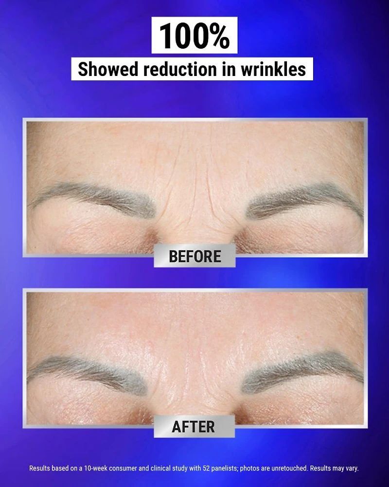 Retinol Fast Release Wrinkle-Reducing Night Serum 0.9 oz.