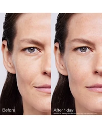Bio Performance Skin Filler Serums Set