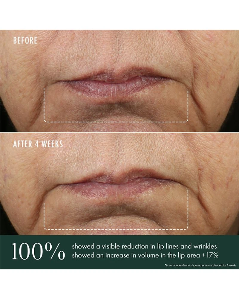 Advanced Lip Perioral Serum Targeted Vertical Line Filler 0.5 oz.