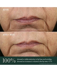 Advanced Lip Perioral Serum Targeted Vertical Line Filler 0.5 oz.