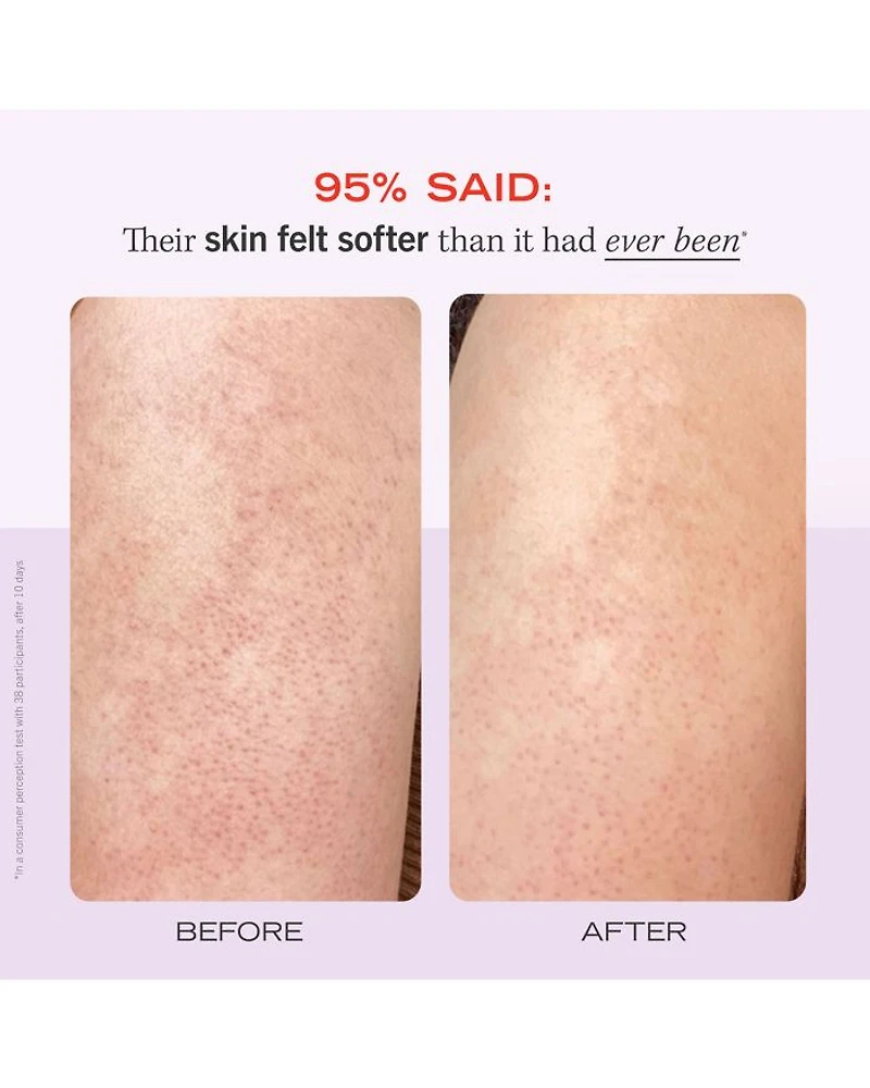 KP Bump Eraser Body Scrub with 10% AHA Exfoliant for Keratosis Pilaris - Strawberry