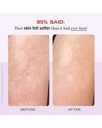 KP Bump Eraser Body Scrub with 10% AHA Exfoliant for Keratosis Pilaris - Strawberry