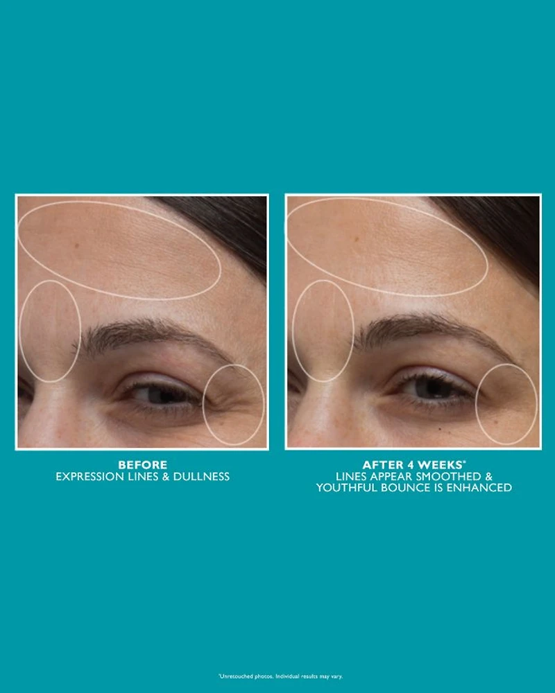 Full Size Peptide Skinjection Stars Line-Smoothing Kit ($120 value)