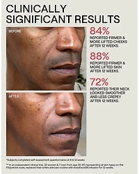 InstaFacial® Collection Infusion Serum 1.18 oz.