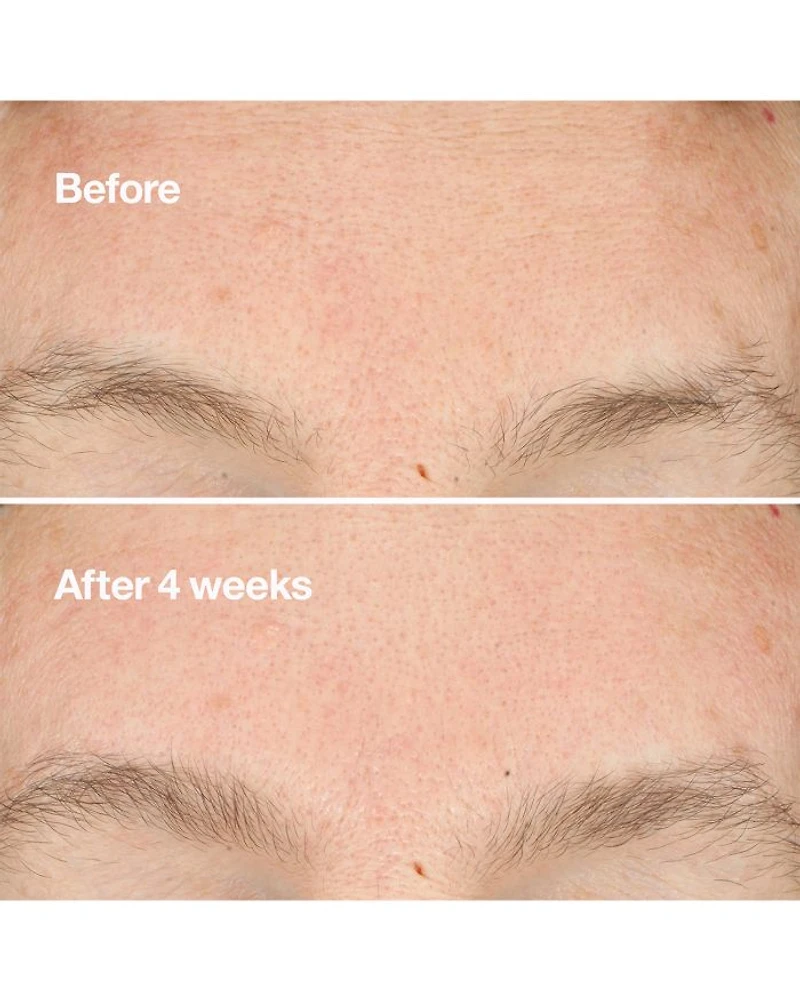 Clarifying Do-Over Peel Peeling Exfoliant 1 oz.