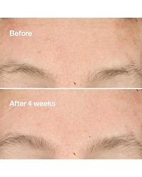 Clarifying Do-Over Peel Peeling Exfoliant 1 oz.