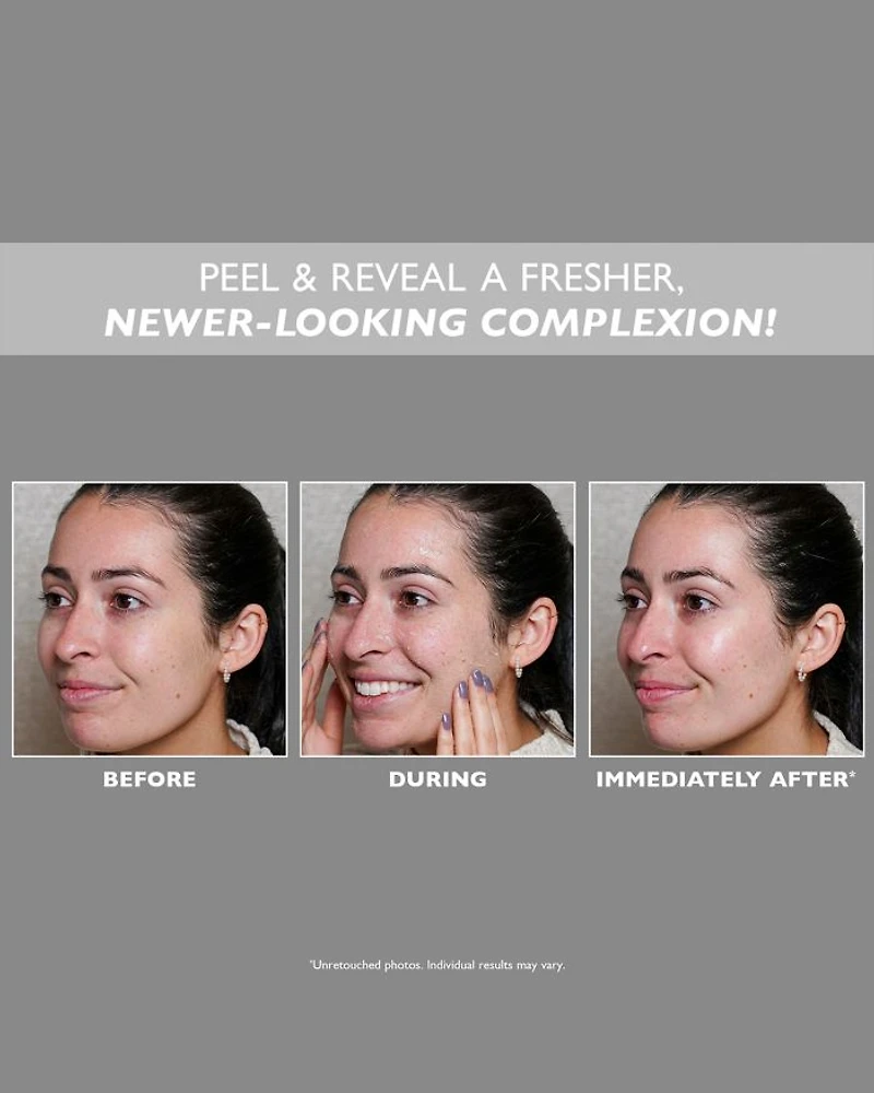 FIRMx Peeling Gel 3.4 oz.