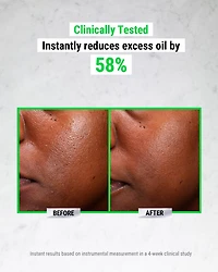 Ultra Pure High-Potency Serum 5.0% Niacinamide 1 oz.