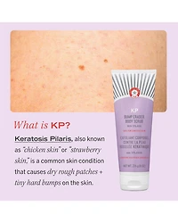 KP Bump Eraser Body Scrub with 10% AHA - Exfoliant for Keratosis Pilaris