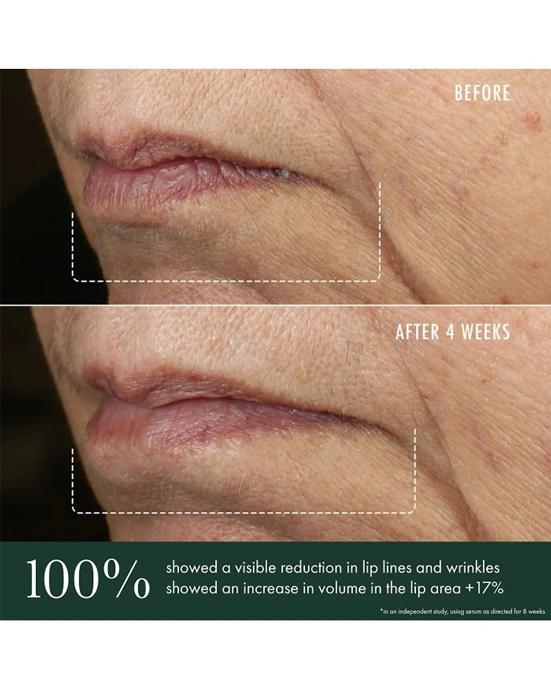 Advanced Lip Perioral Serum Targeted Vertical Line Filler 0.5 oz.