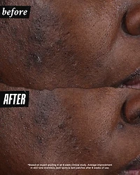 Auto Tone Discoloration & UV Solution 1.4 oz.