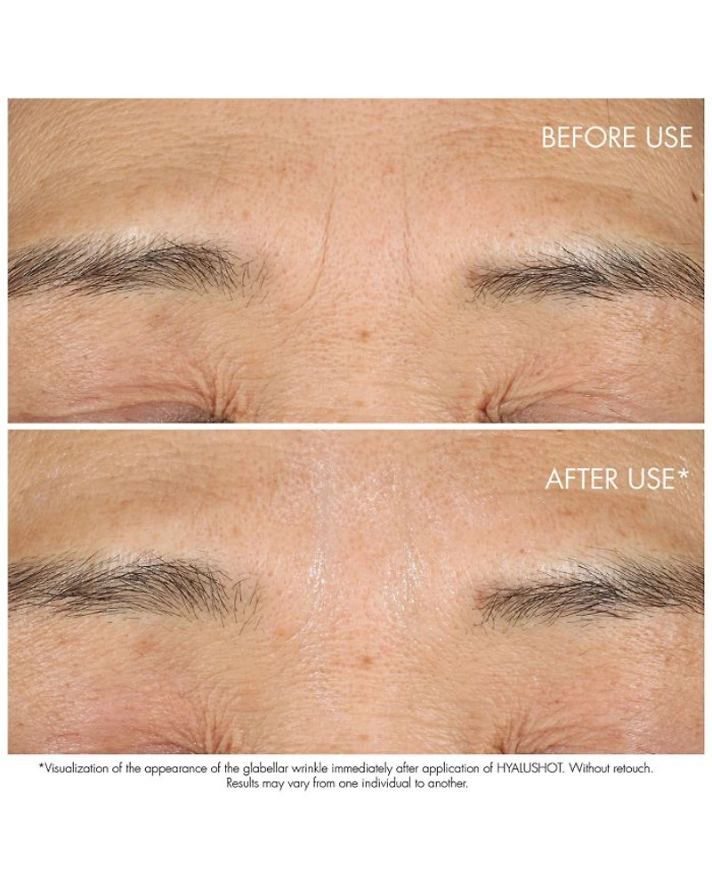 Capture Totale Hyalushot Wrinkle Corrector With Hyaluronic Acid 0.5 oz.