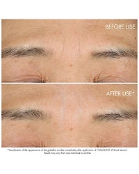 Capture Totale Hyalushot Wrinkle Corrector With Hyaluronic Acid 0.5 oz.
