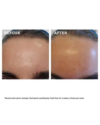 Beauty Flash Peel with BHA & AHA 1.7 oz.